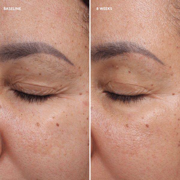 Total Eye® Firm & Repair Cream - Bilde 6
