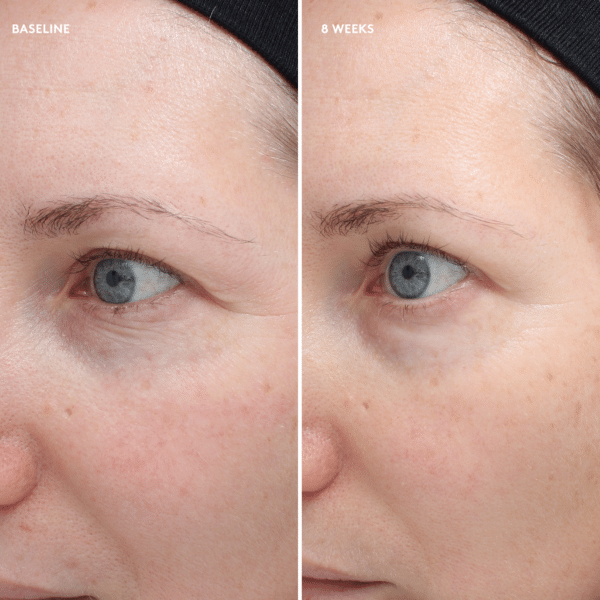 Total Eye® Firm & Repair Cream - Bilde 7